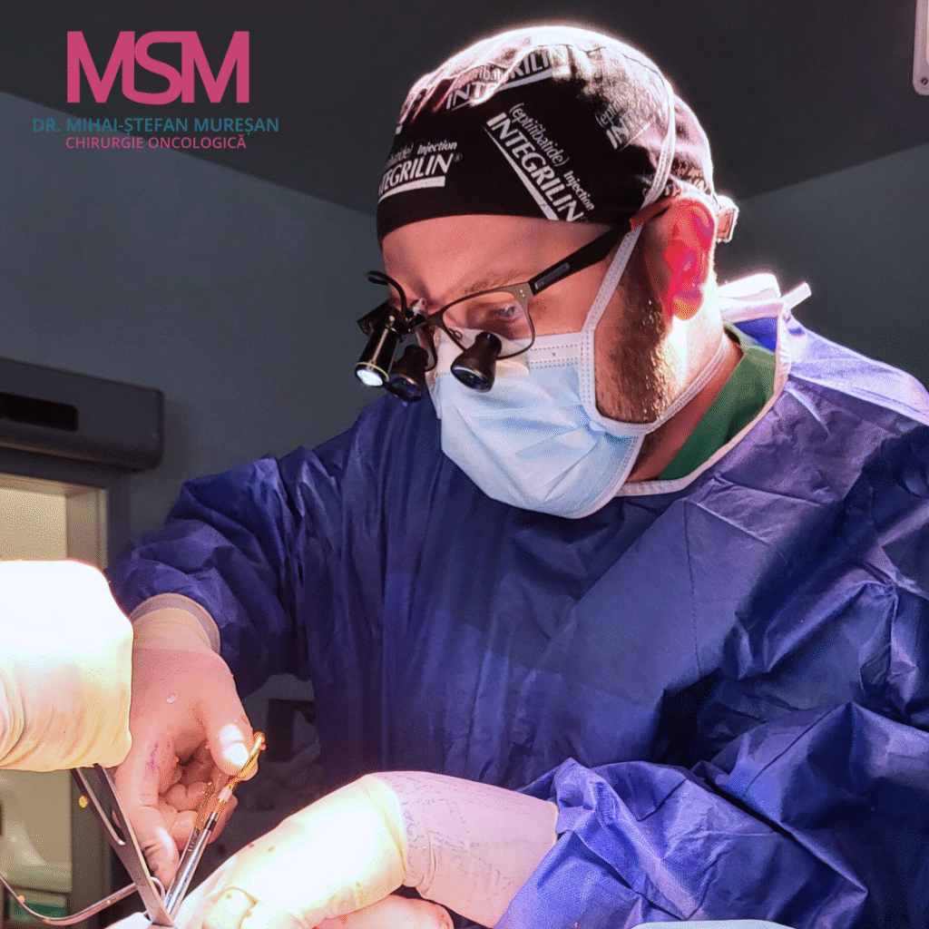 Chirurgia conservatoare a sânului