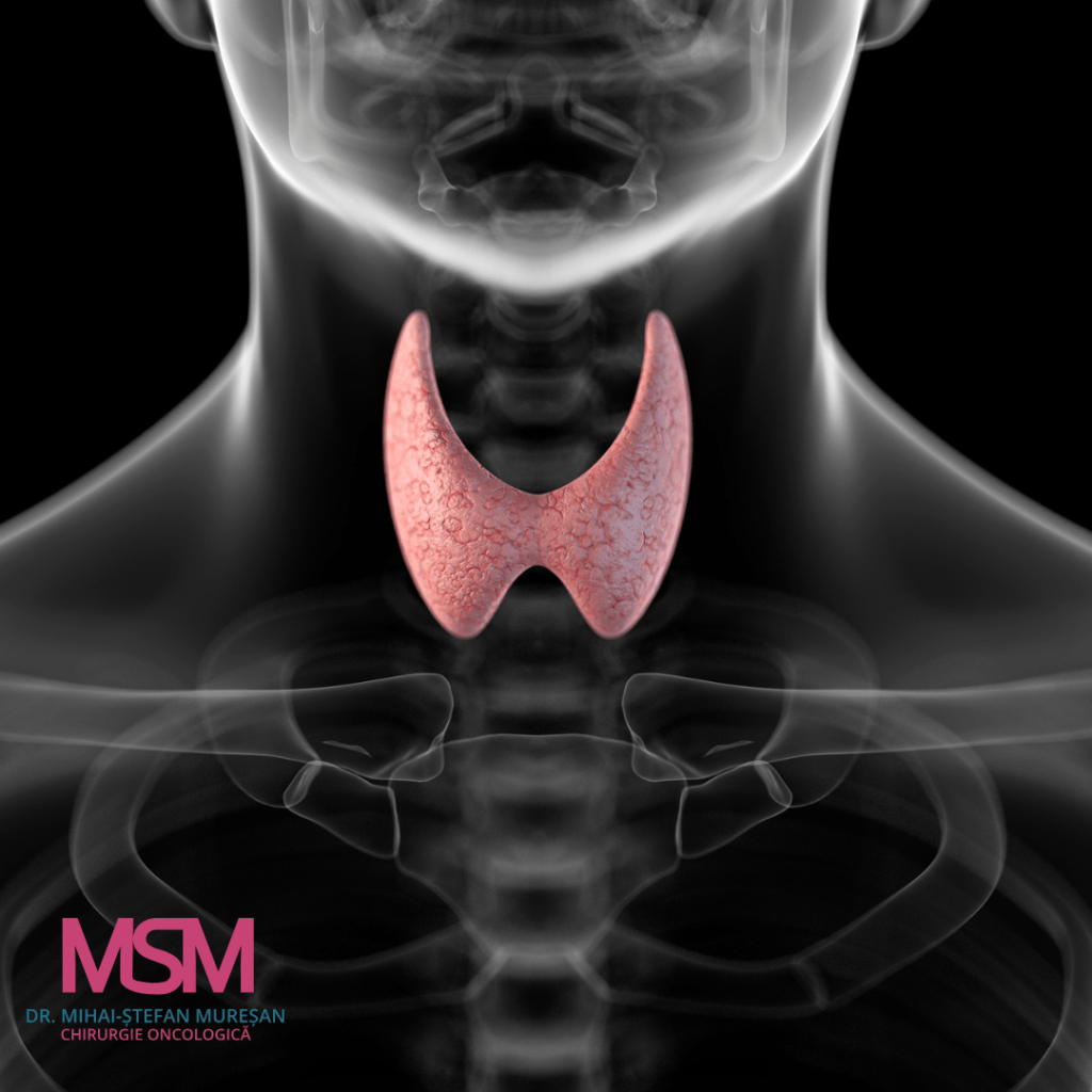 Lobectomia tiroidiană